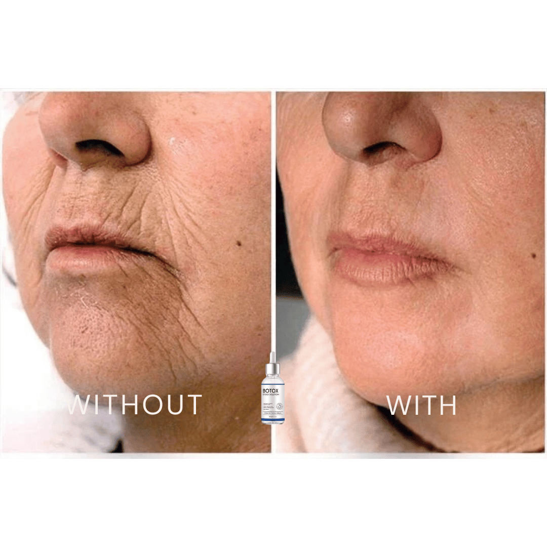 FACELIFT | Babybotox Face Serum