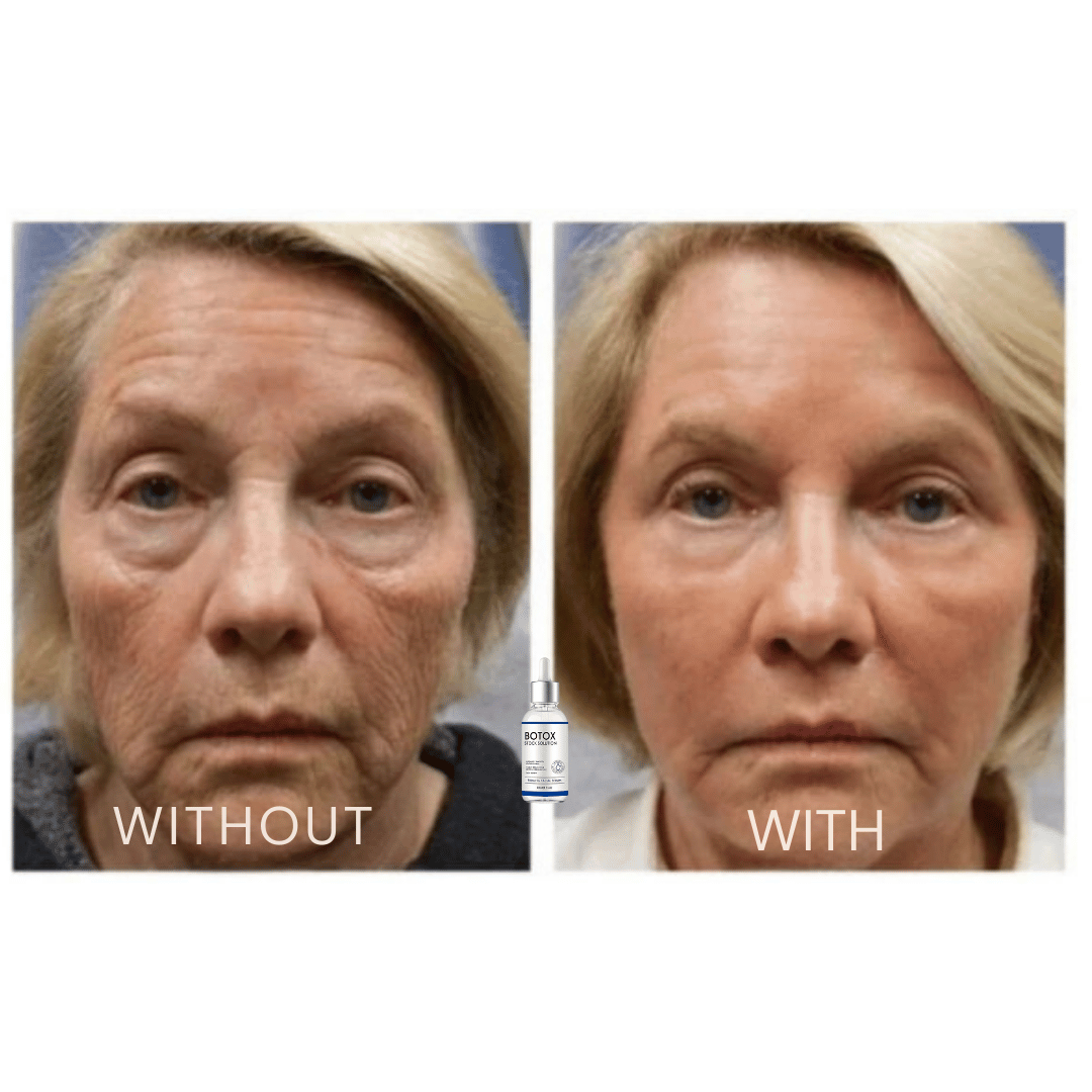 FACELIFT | Babybotox Face Serum