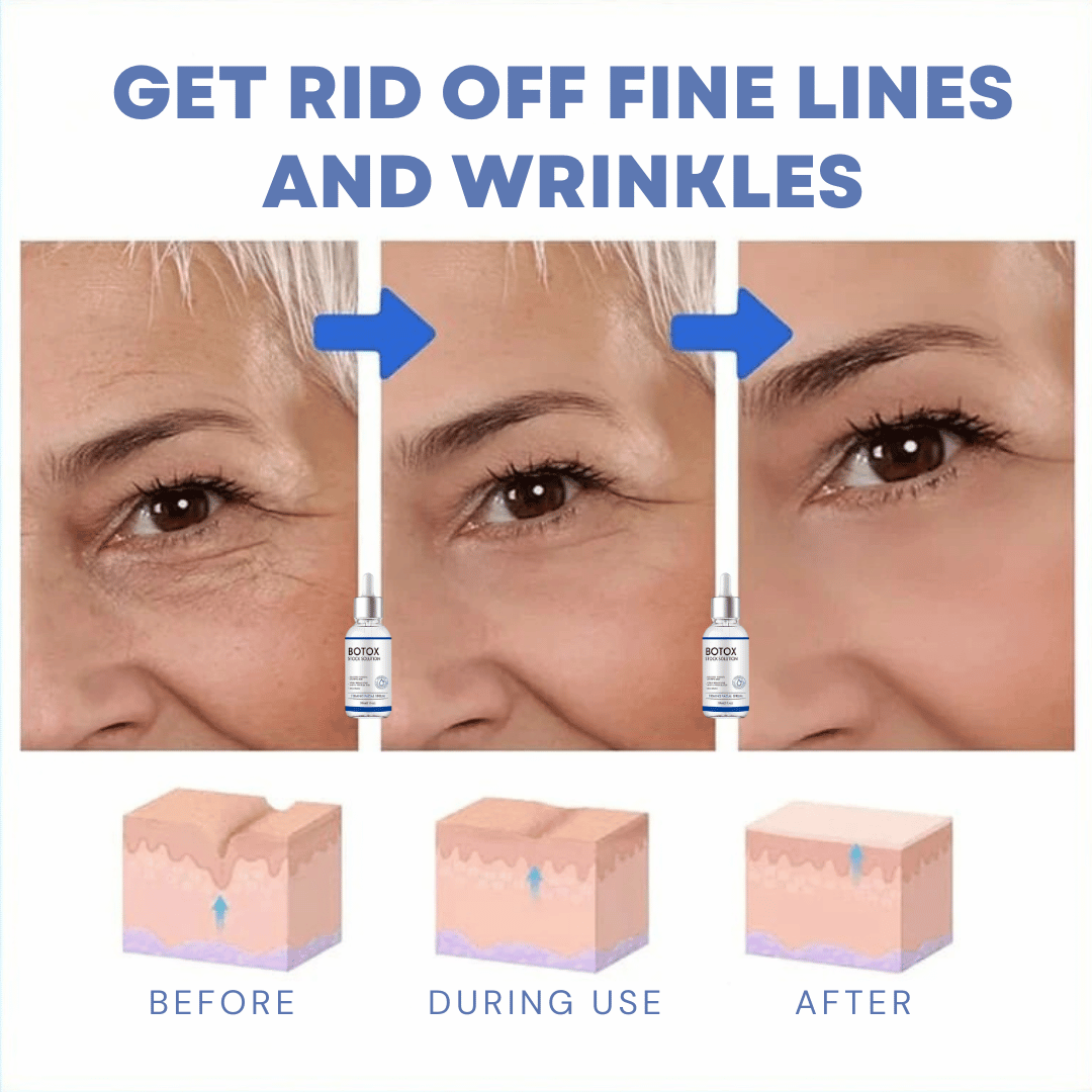 FACELIFT | Babybotox Face Serum