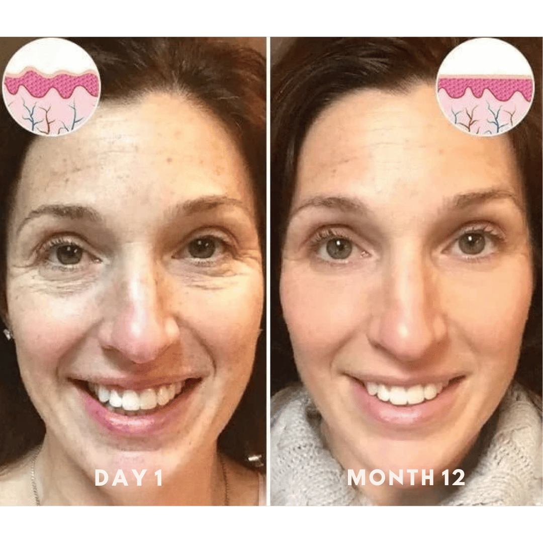 FACELIFT | Babybotox Face Serum