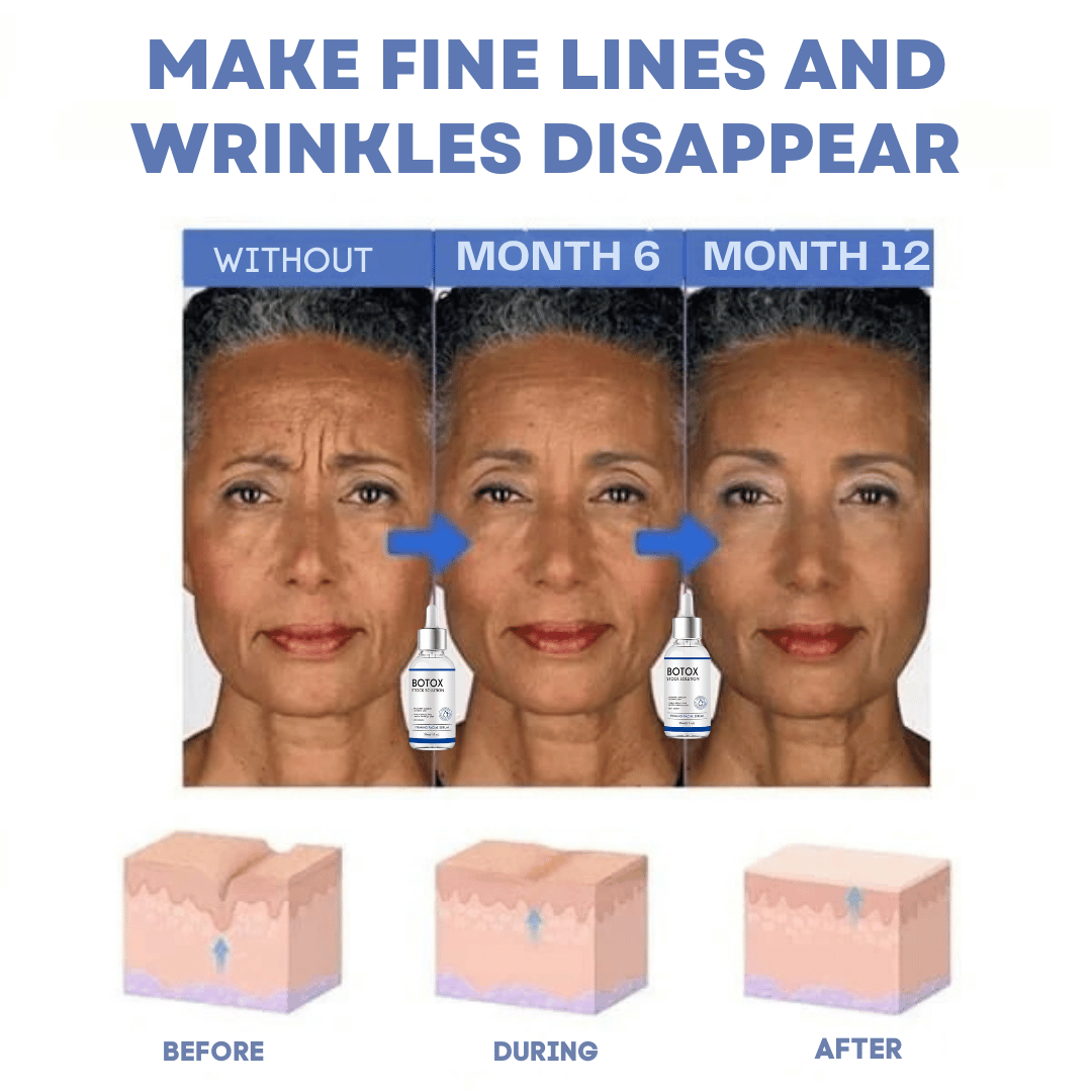 FACELIFT | Babybotox Face Serum